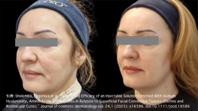 スーパーハイドロの症例